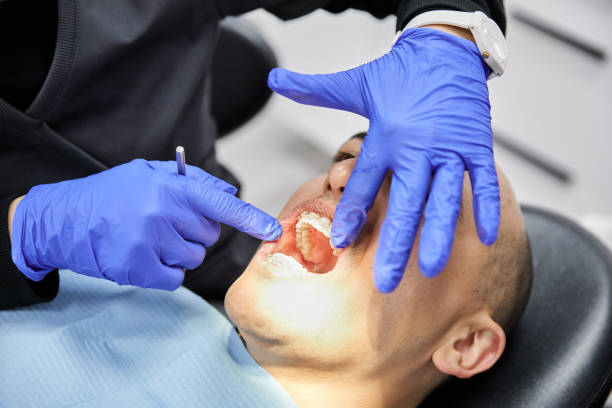 Best Dentist for Dental Trauma  in South Browning, MT
