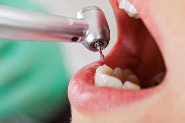 Best Broken Tooth Emergency  in South Browning, MT